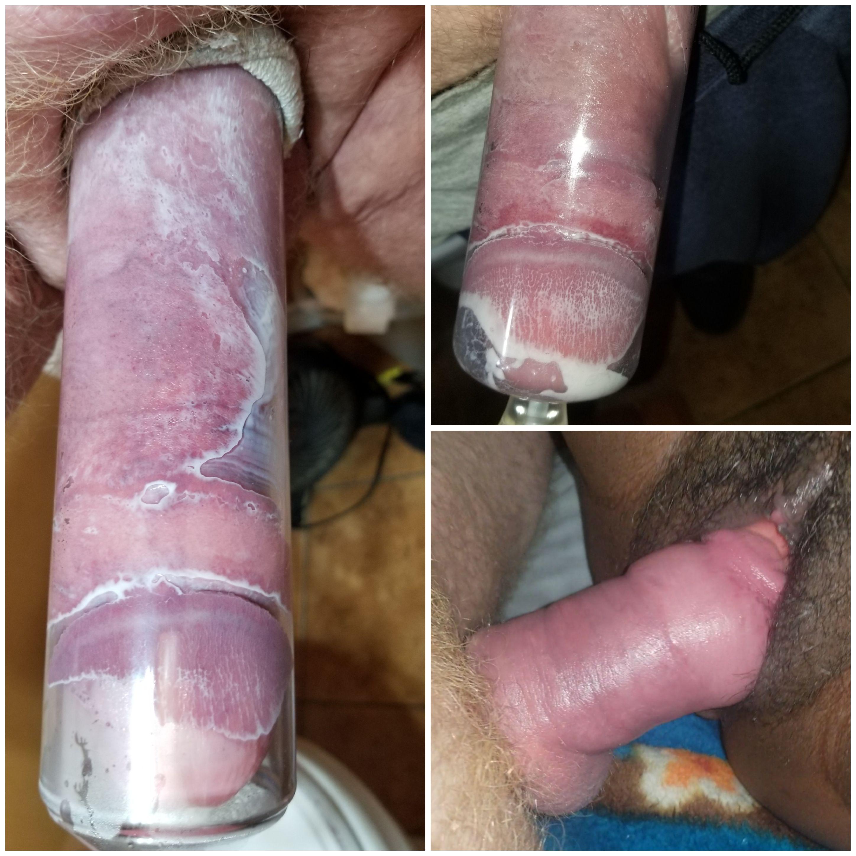 Pumping changed my life. When I packed the 8×2 it was exciting. The 9×2.5 amazing! I was a little over 5 inches erect before pumping. Now close to 9. The increase in thickness is what my Wife loves! The look on her face when she says 